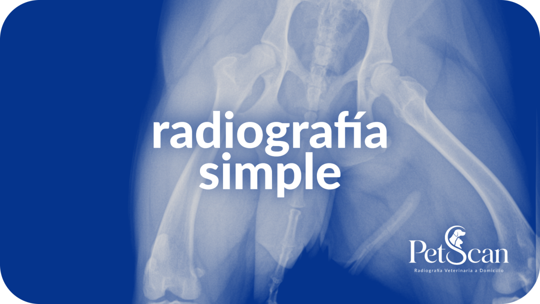 Radiografía simple