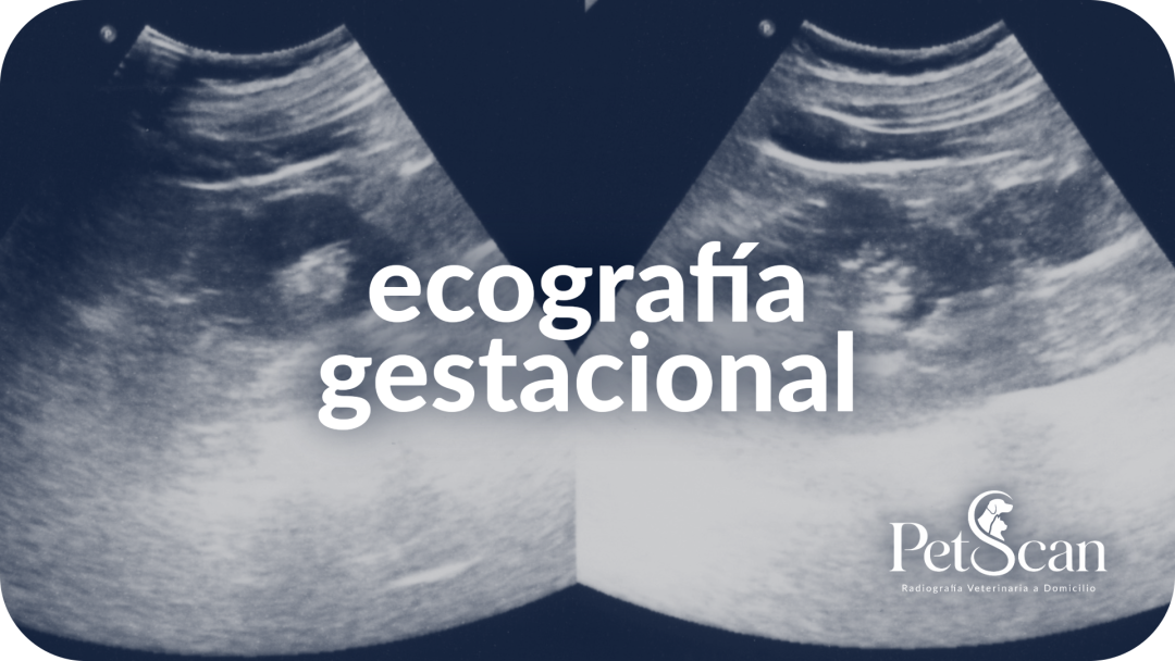 Ecografía gestacional