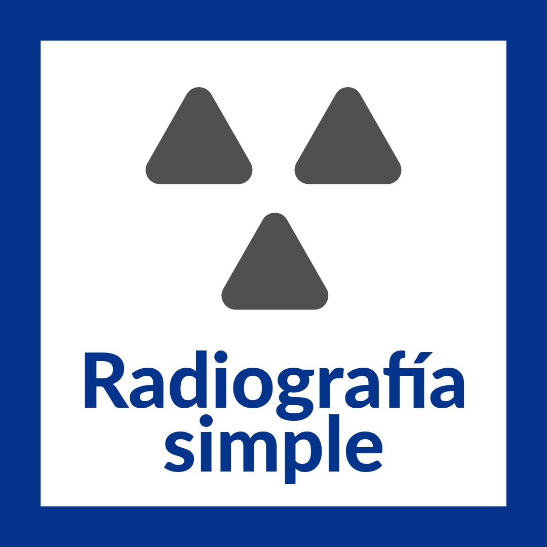 radiografía simple